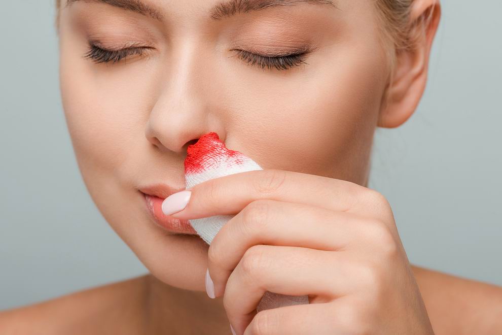 éjszakai orrvérzés okai